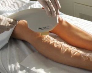 mesoterapia virtual